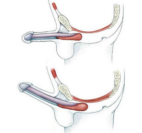 Penis without training pubococcygeus muscles and after training