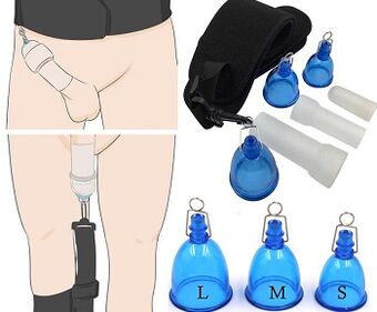 The impact of using pumps to increase membership