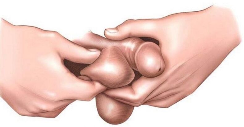 Why does eggs itch in men